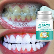 5-Day Teeth Whitening Powder