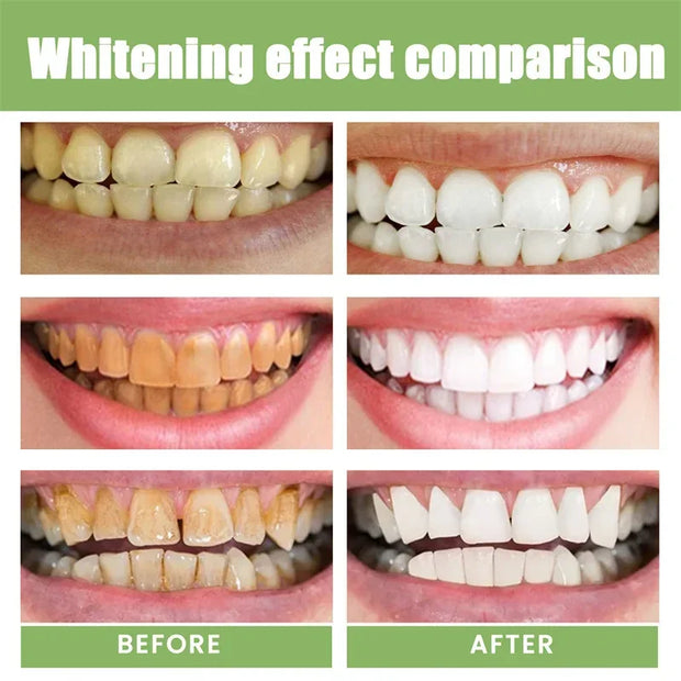 5-Day Teeth Whitening Powder