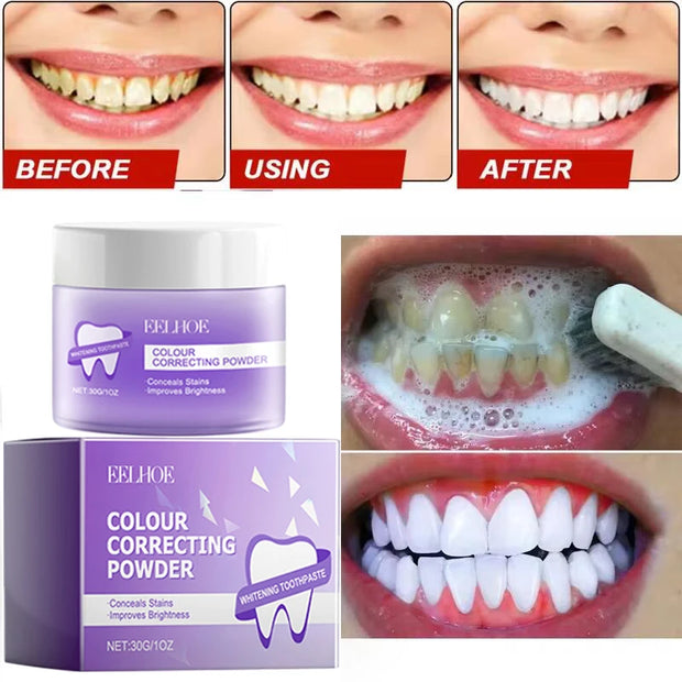 5-Day Teeth Whitening Powder